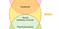 Multiple Endocrine Neoplasia