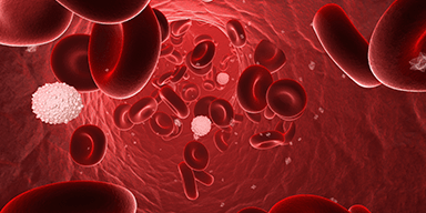 Hematopoietic Malignancies: Putting It All Together
