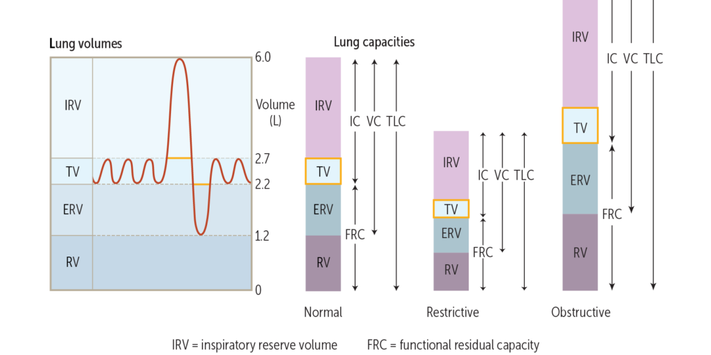 Obstructive and Restrictive Lung Disease